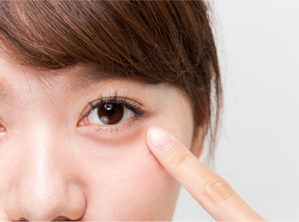 切らない目の下のクマ・たるみ治療