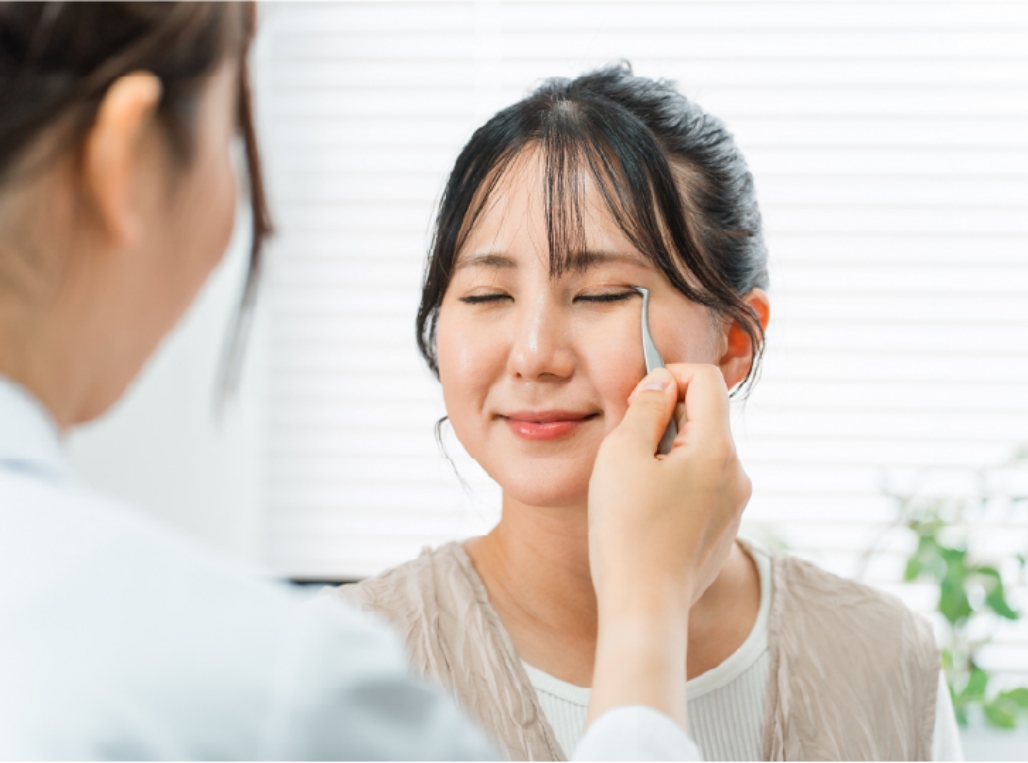 二重埋没法（二重整形）