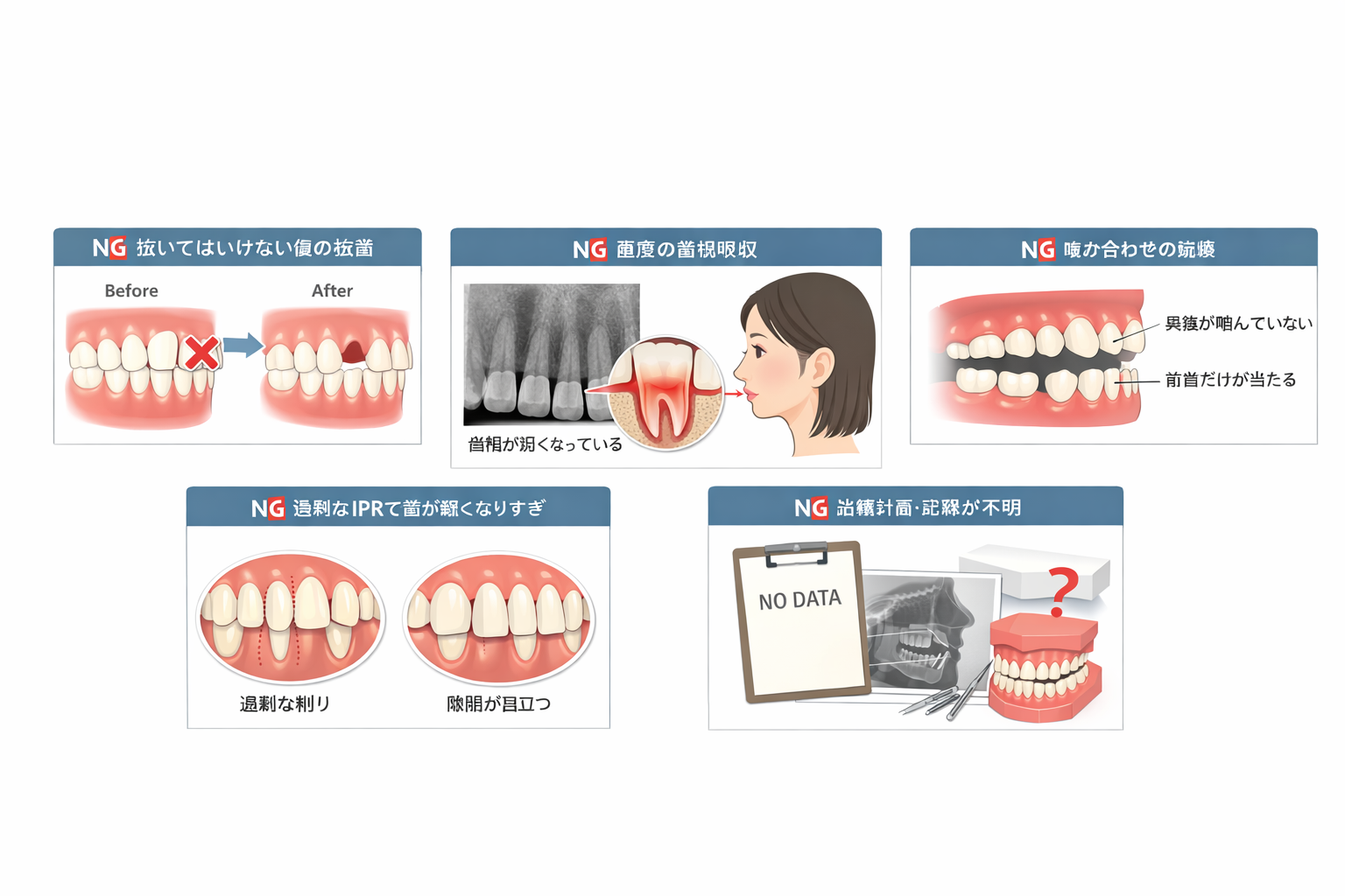 マウスピース矯正の失敗をワイヤー矯正でやり直せる？