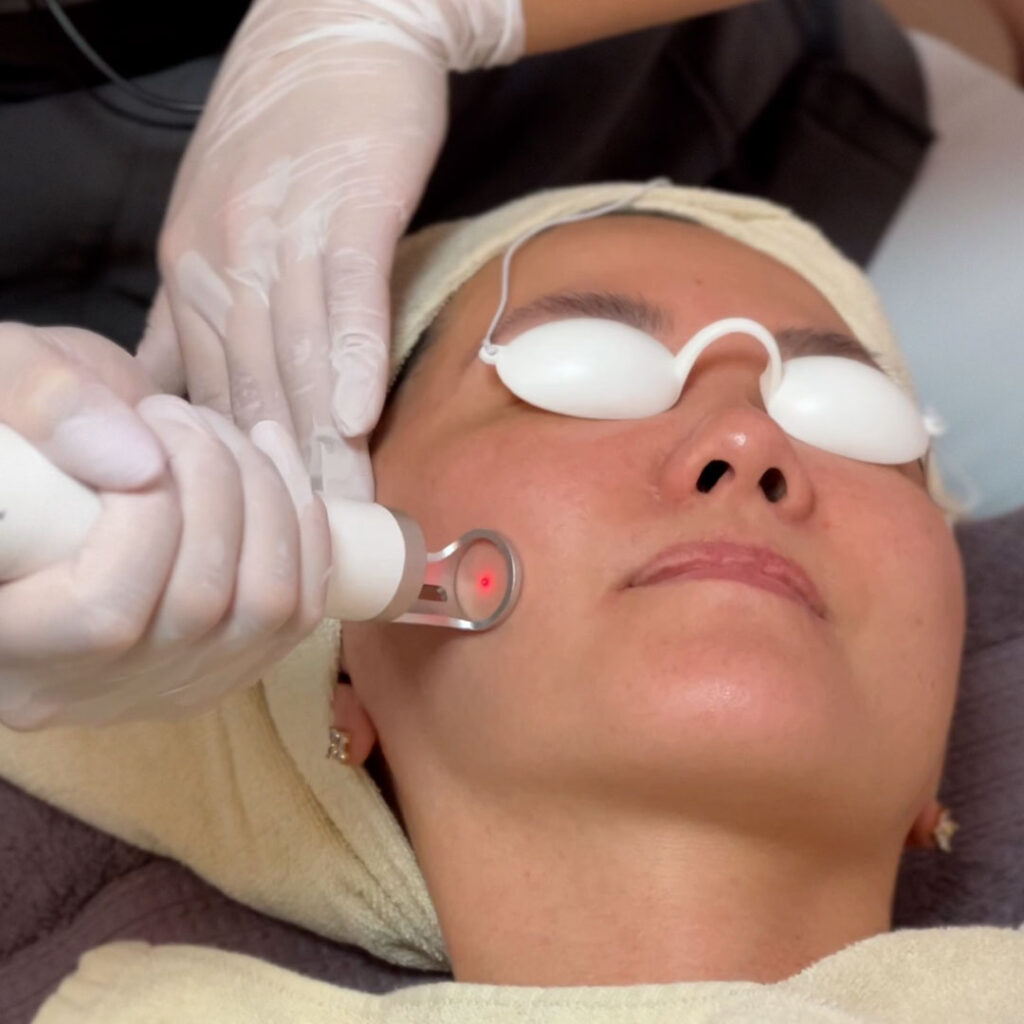 ピコロ照射画像